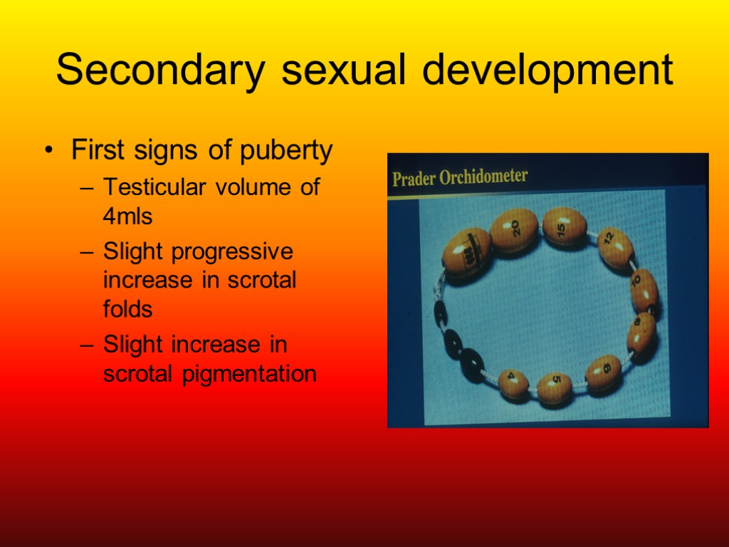 Secondary sexual development First signs of puberty Testicular volume of 4mls Slight progressive increase